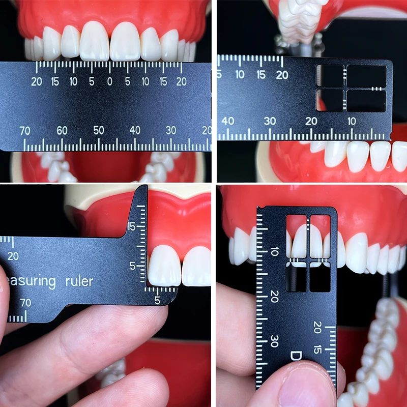 Photography Rules - Righello per la misurazione dei denti
