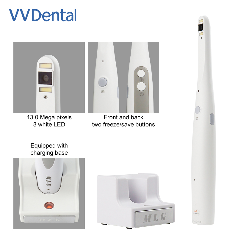 Telecamera Intraorale Dentale  - Photography Dental recensione e prezzo