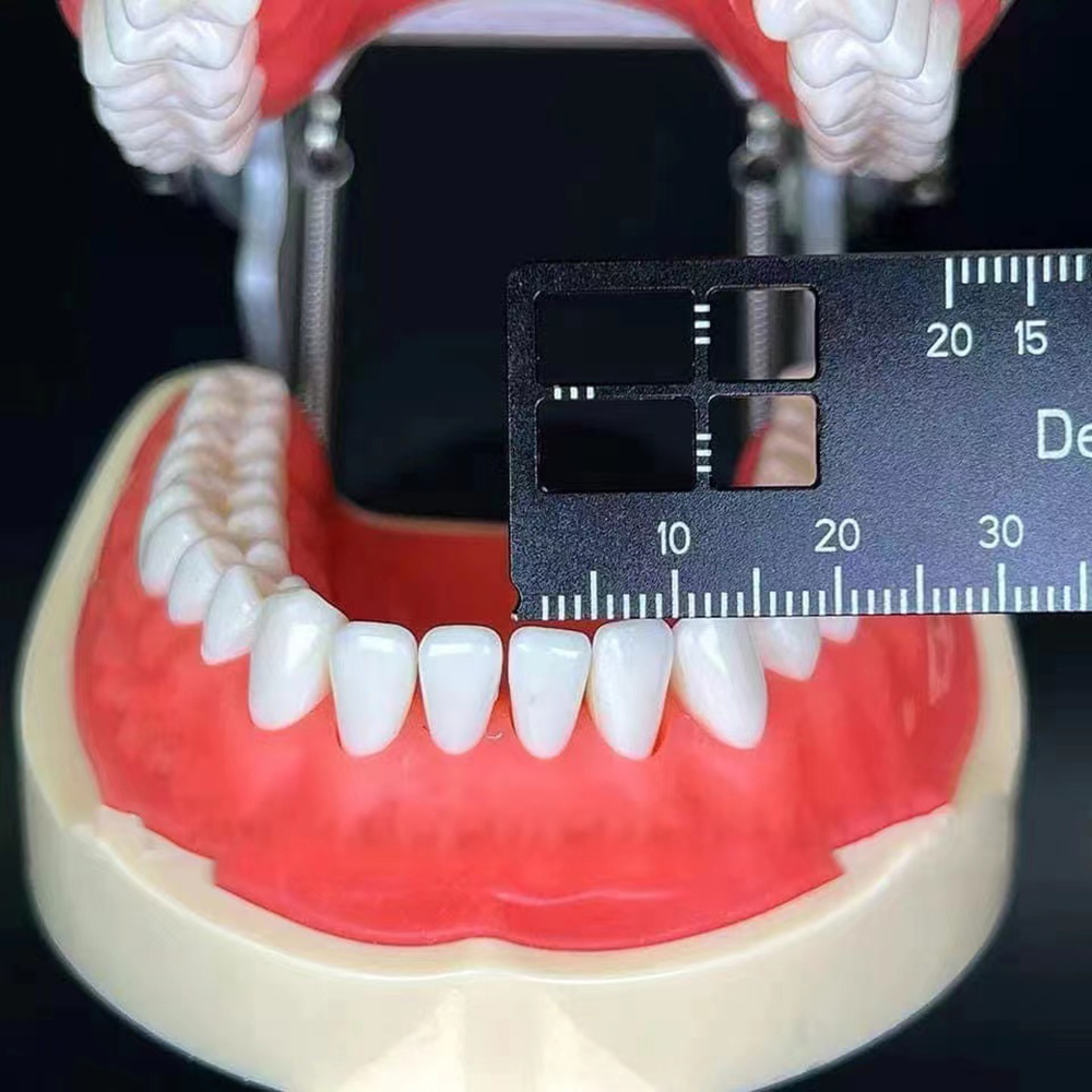 PIORPOY 1 Pz Dentale Precision - Photography Rules recensione e prezzo