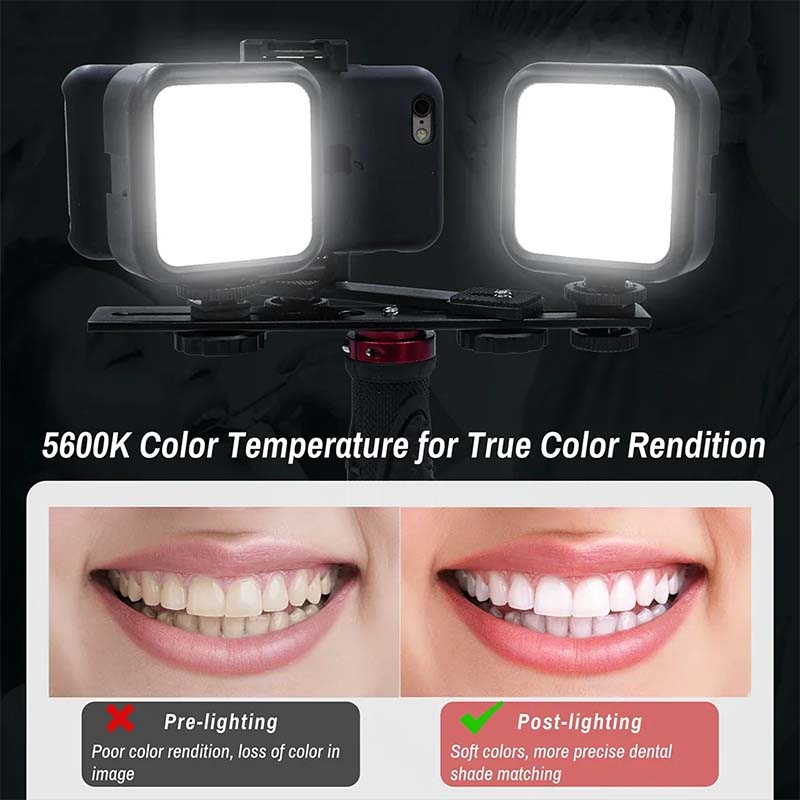Luce per fotografia dentale co - Photography Dental recensione e prezzo